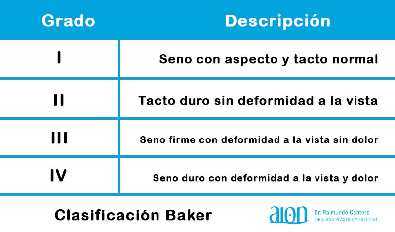 clasificacion contractura capsular baker